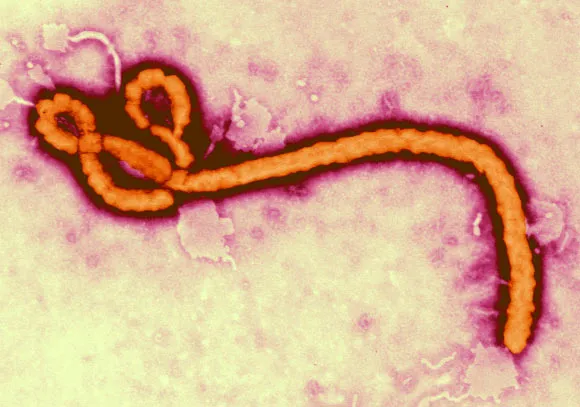 Transmission electron micrograph of an Ebola virus virion, showing its characteristic filamentous shape