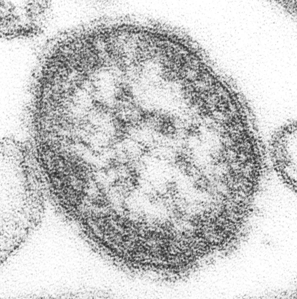 Transmission electron micrograph of a single measles virus particle