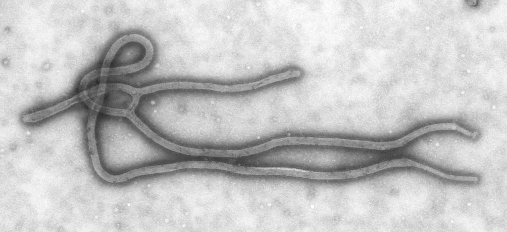 Transmission electron micrograph of the Ebola virus (CDC, public domain); a laboratory illustration, not a view of North Ubangi.