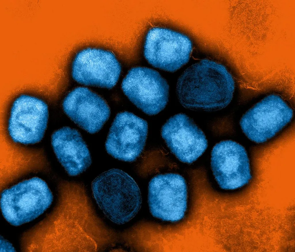 Colorized electron micrograph of mpox virus particles in blue