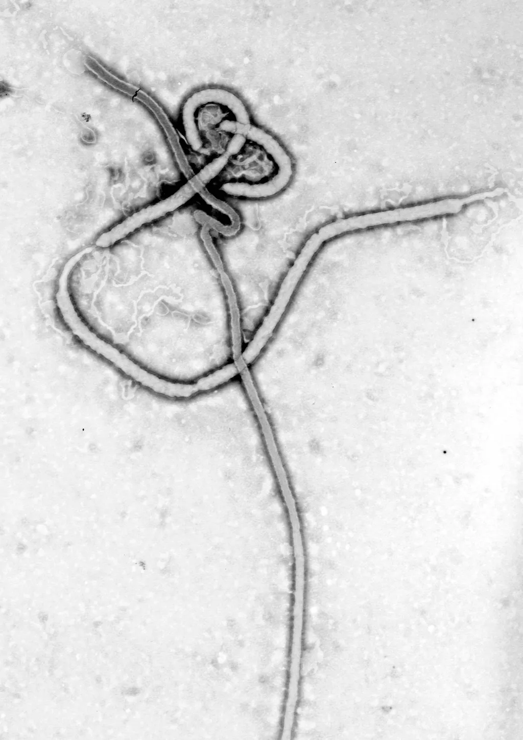 Electron micrograph of an Ebola viral particle showing its characteristic filamentous shape