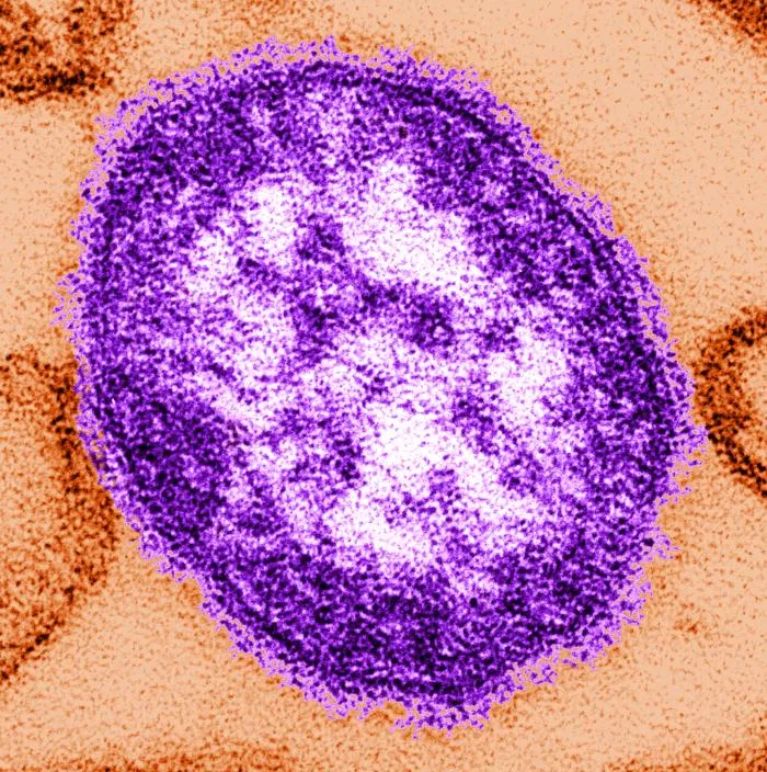 Colorized transmission electron micrograph of a measles virus particle, courtesy of the CDC.